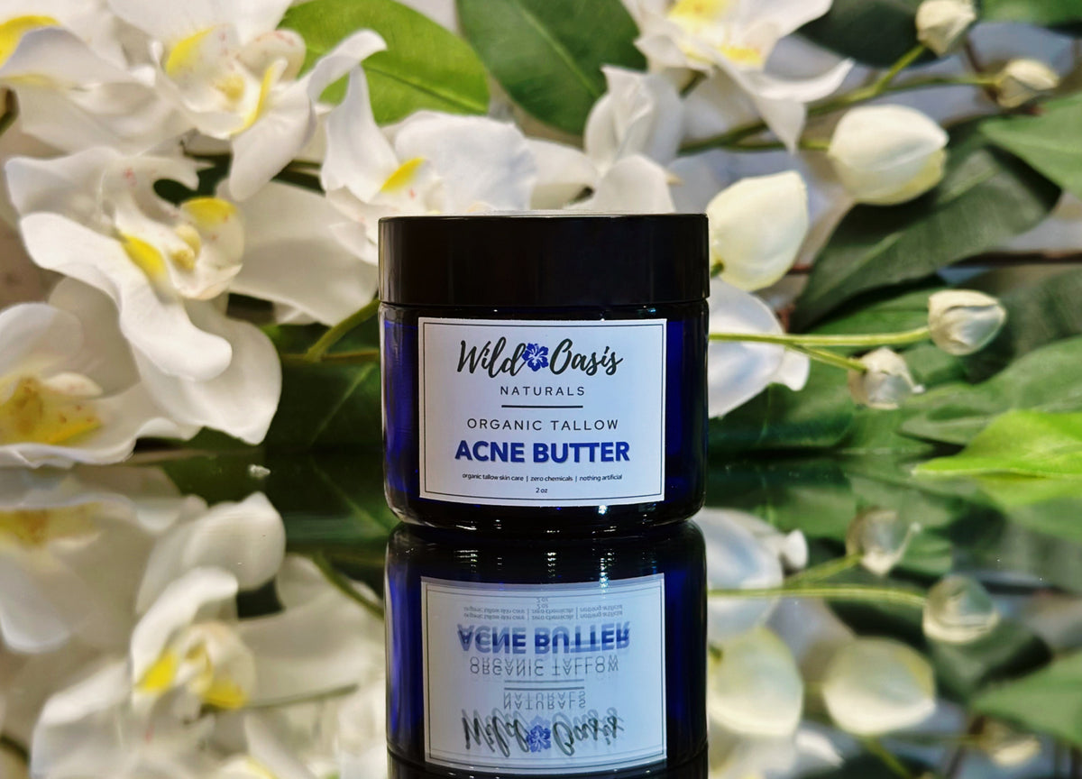 Acne Butter - Organic Tallow Acne Cream